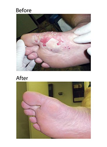Dr. Nordyke's Wound Honey New Zealand Manuka Honey for Infections,Burns,Cuts and Scars (80g)