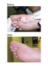 Dr. Nordyke's Wound Honey New Zealand Manuka Honey for Infections,Burns,Cuts and Scars (80g)