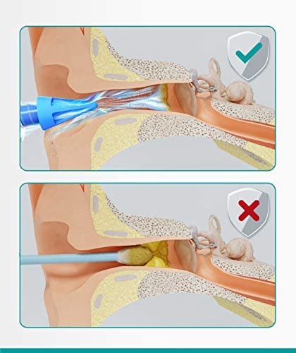Medi Grade Ear Cleaner Ear Wax Remover - Ear Wax Removal Kit with 3X Soft Quad-Stream Tips. Clean Ears Naturally with Our Reusable Ear Cleaning Kit & Earwax Removal Tool for at-Home Ear Wax Removal