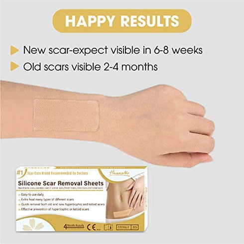 Silicone Scar Removal Sheets, Scar Away Silicone Scars Sheets for C-Section, Acne, Surgery Injuries, Keloid, Burn, Stretch Marks, Works on Recent & Old Scars, 4 Sheets 5.7’’ x 1.57”