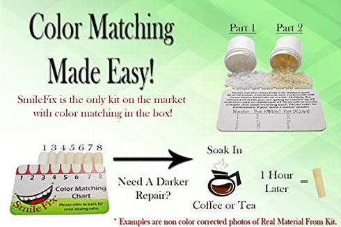 SmileFix Standard Color Matching Dental Repair Kit – Replace Missing or broken tooth. Gaps, broken teeth space temporary quick & safe. Regain your confidence and beautiful smile in minutes at home!