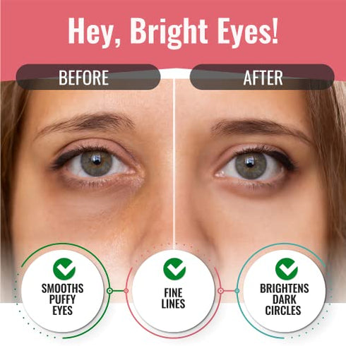 Look At Me Under Eye Mask Dark Circles and Puffiness (10 Pairs). Korean Skin Care Green Tea Hydrogel Eye Patch / Under Eye Pads. Dark Circle Remover and Collagen Eye Mask for Puffy Eyes.