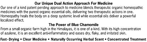 Forces of Nature -Natural, Organic Psoriasis Relief (11ml) Non GMO
