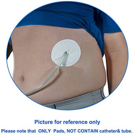 Gtube Pads Holder G Tube Button Pads Peritoneal Dialysis Feeding Tube Peg Tube Supplies for Nursing Care (12 Pack)
