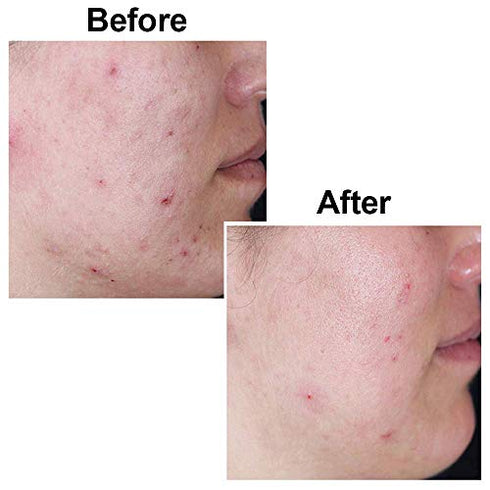 Original Kojie San Body Lotion - Controls Hyperpigmentation and Reduces the Appearance of Visible Skin Blemishes - Guaranteed Authentic (150ml)