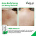 Face, Body Acne Spray with Benzoyl Peroxide - Salicylic Acid - Butt, Back Acne Treatment - Cystic Hormonal Acne Treatment, Body, Chest Spray with Tea Tree Oil - for Men, Women, Teens - Acne Body Spray