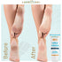 LOVE, LORI Urea Cream 40 Percent for Feet 4 oz Foot Cream For Dry Cracked Feet - Callus Remover & Foot Repair Treatment - Moisturizes Heels, Hands, Knees & Elbows - For Thick, Rough & Dry Skin