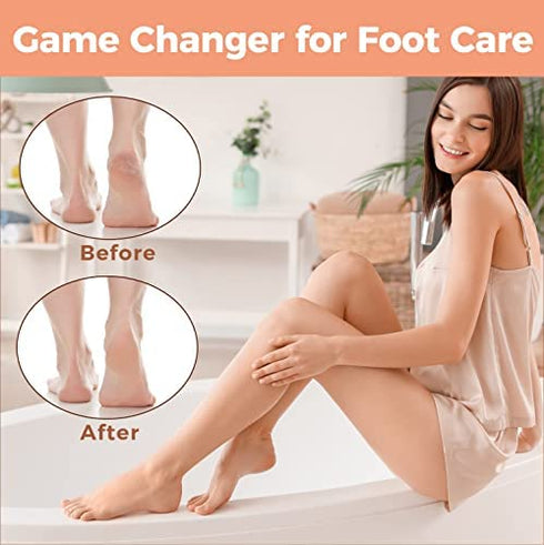 Foot File Foot Scrubber Pedicure - Callus Remover for Feet Easkep Professional Foot Grater Rasp Foot Scraper Corns Callous Removers Dry Skin Cracked Dead Skin Remover for Dry and Wet Feet (Golden)