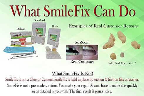 SmileFix Standard Color Matching Dental Repair Kit – Replace Missing or broken tooth. Gaps, broken teeth space temporary quick & safe. Regain your confidence and beautiful smile in minutes at home!