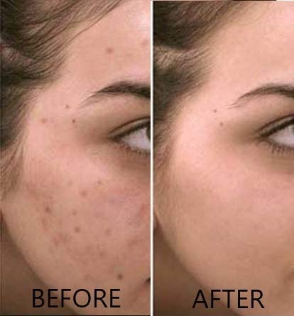 Vitamin C Serum 20% Pure L-Ascorbic Acid, Ferulic Acid, Vitamin E and Hyaluronic Acid for Face and Eyes Natural Anti Aging Anti Wrinkle 1oz. by Dr. Brenner (1 oz)