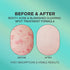 Butt Acne Clearing Spot Cream. Helps Clearing Acne, Cellulite, Ingrown Hairs, Blackheads, Zits, Razor Bumps and Dark Spots for the Buttocks and Thigh Area. Prevents Future Breakouts.