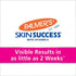 Palmer's Skin Success Anti-Dark Spot Fade Cream for Dry Skin, 4.4 Ounce