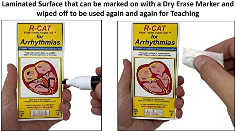 R-CAT for Arrhythmias EKG Pocket Reference Guide – Great Study Card for EKG Interpretation - ACLS and PALS Training – Cardiac Rhythm Interpretation Made Easy