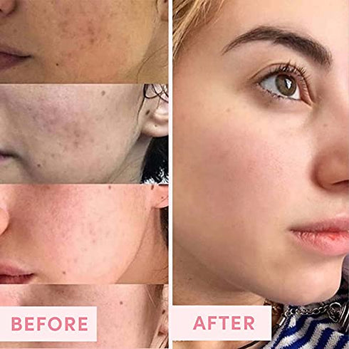 Sand & Sky Australian Pink Clay Face Mask - Travel Size Pore Mask & Facial Mask Skin Care Set | Limited Edition Pore Minimizer Face Mask Set.