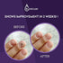 V20 Vite 20 Antifungal Cream Fungus Killer Hand and Feet Nail Treatment