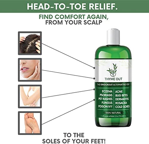 Thyme Out Natural Skin Treatment for Eczema Relief, Psoriasis, Acne, Dermatitis, Rosacea, Cold Sores, Pet Rashes, Bug Bites, Fungus, Poison Ivy, Anti Itch Spray for Kids, Adults & Baby (Skin Spray)
