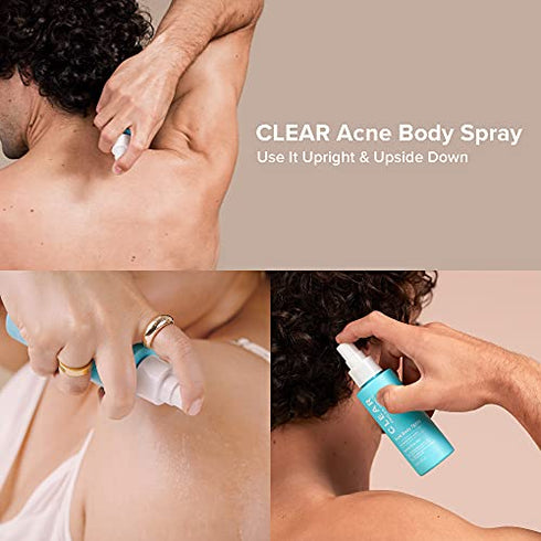 Paula's Choice CLEAR Back and Body Acne Spray, 2% Salicylic Acid Treatment for Blackheads & Blemishes, 4 Ounce