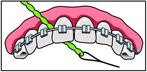 IDontix Brace X-Floss, Green