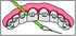 IDontix Brace X-Floss, Green