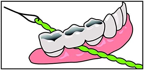 IDontix Brace X-Floss, Green