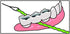 IDontix Brace X-Floss, Green