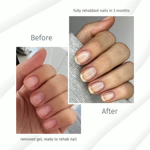 duri Rejuvacote 1 Original Maximum Strength Nail Growth System Base,Top Coat - Treatment, Nail Repair