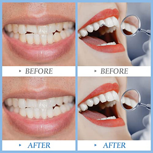 56 Pieces Synthetic Dental Acrylic Resin Teeth 50g Solid Temp Tooth Beads 23 Shade A2 Upper + Lower Denture for Halloween Makeup, DIY & Replacement for Filling Fix The Missing Broken Tooth