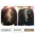 Spectral.DNC-N Leave In Serum to Support Hair Growth by DS Laboratories - Minoxidil Alternative for Men and Women, Experience Fuller, Thicker Hair, Water Based Formula (2 fl oz)