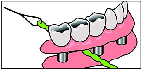 IDontix Brace X-Floss, Green