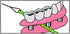 IDontix Brace X-Floss, Green