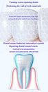 CAREDO Healing Teeth Crack Toothpaste, The ONLY Toothpaste Repairing Cracked Teeth Enamel Cracks, Cure Tooth Sensitivity, Root Damage Teeth Displacement Treatment, Remove Pigment in Crack 100g 1 Count