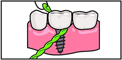 IDontix Brace X-Floss, Green