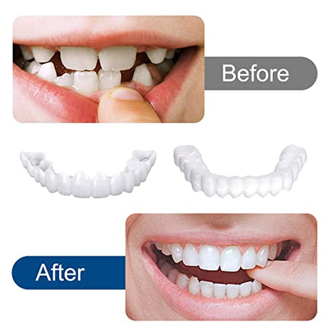 4 Pairs Veneers Snap in Teeth Teeth Comfort Fit Whitening Veneer Snap on Dentures with Woman & Man Party in Smile Beautiful Snapping Instants