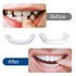 4 Pairs Veneers Snap in Teeth Teeth Comfort Fit Whitening Veneer Snap on Dentures with Woman & Man Party in Smile Beautiful Snapping Instants