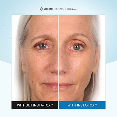 Serious Skincare INSTA-TOX Instant Wrinkle Smoothing Serum TRIO - Improves appearance of Fine Lines & Wrinkles -Temporarily Tightens Skin - Instant Line Filler - Three .75 oz. Tubes (3Pack)