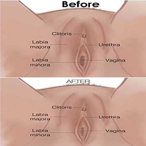 Arunkriss Herbs Yoni Steaming Herbs 5 Steams Vigina Tighting Feminine Steam Cleansing The Repair Grass Tightening Herb Firming and Repair for Women