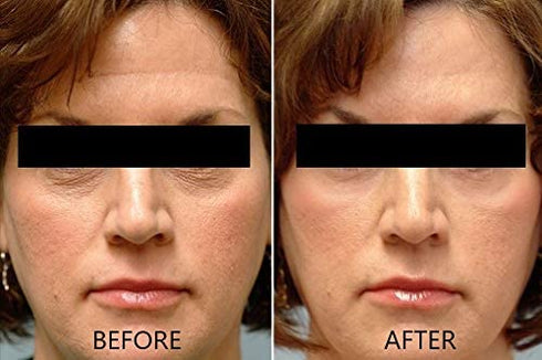 Vitamin C Serum 20% Pure L-Ascorbic Acid, Ferulic Acid, Vitamin E and Hyaluronic Acid for Face and Eyes Natural Anti Aging Anti Wrinkle 1oz. by Dr. Brenner (1 oz)