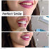 Denture Teeth Temporary Fake Teeth for Snap on Instant & Confidence Smile