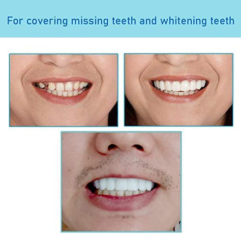 Denture Teeth Temporary Fake Teeth for Snap on Instant & Confidence Smile