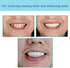 Denture Teeth Temporary Fake Teeth for Snap on Instant & Confidence Smile