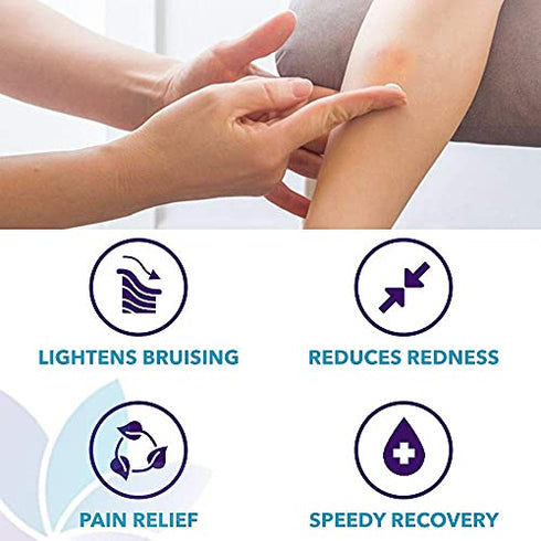 Diva Stuff Bruise Busting Treatment Cream, for Those Who Bruise Easily, with Arnica Butter, Lavender and Turmeric, All Natural, 4 oz