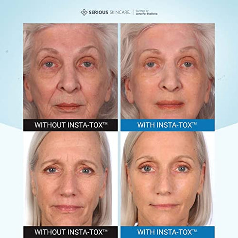 Serious Skincare INSTA-TOX Instant Wrinkle Smoothing Serum TRIO - Improves appearance of Fine Lines & Wrinkles -Temporarily Tightens Skin - Instant Line Filler - Three .75 oz. Tubes (3Pack)