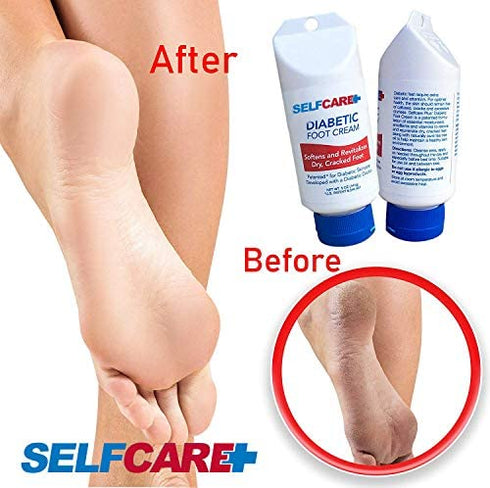 Diabetic Foot Cream Revitalize Cracked Feet & Promote Circulation. Leaves Hands Legs & Body Smooth Patented Lotion, 5 oz