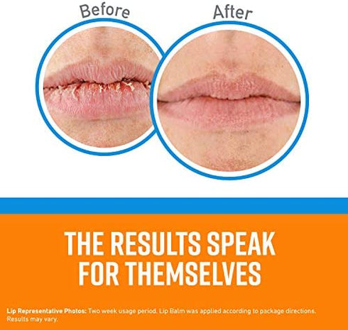 O'Keeffe's Cooling Relief Lip Repair Lip Balm for Dry, Cracked Lips, .35 Ounce Tube, (Pack of 6)