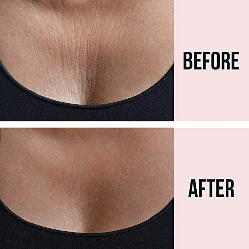 SiO Beauty SkinPad Silicone Chest Anti-Wrinkle Patches (2 Weeks Supply) - Reusable Overnight Smoothing Decollette Pad - Anti-Aging Patch For Neck & Cleavage
