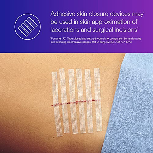 3M™ Steri-Strip™ Reinforced Adhesive Skin Closures, R1546, 1/4 in x 4 in (6 mm x 100 mm), 10 Strips/Envelope
