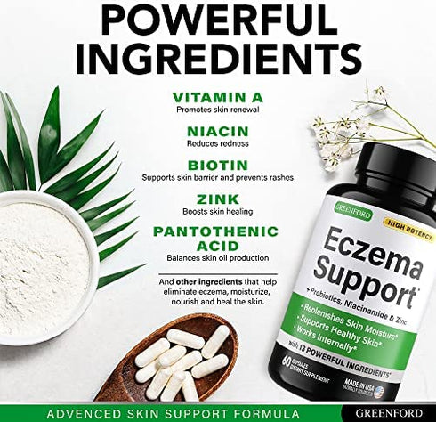 Eczema Treatment & Support for Natural Relief - Made in USA Dupixent Alternative - Skin Vitamins & Herbals for Eczema, Acne, Psoriasis, Rosacea Treatment with Zinc, Niacinamide & Probiotics - 60 caps