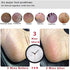 Kinepi Foot File Callus Remover Foot Scrubber,Professional Pedicure Foot Rasp Removes Cracked Heels,Dead Skin,Corn,Hard Skin,Pumice Stone for Feet Scraper File Brush Tools for Wet and Dry Feet