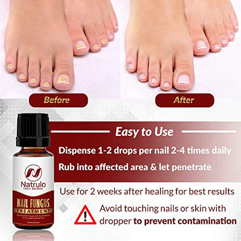 Nail & Toenail Fungus Treatment - Natural Anti Fungal Nail Balm with Tea Tree Oil - 100% Pure Liquid Homeopathic Infection Fighter Remedy - Destroys Fungus & Restores Clear Healthy Nails, Made in USA