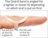 Oval-8 Finger Splint Graduated Set - Sizes 8, 9, 10